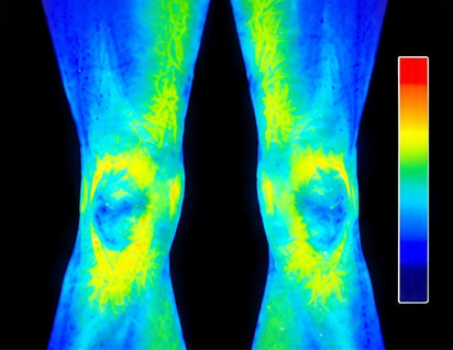 Knee Region