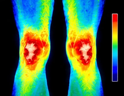 Knee Region